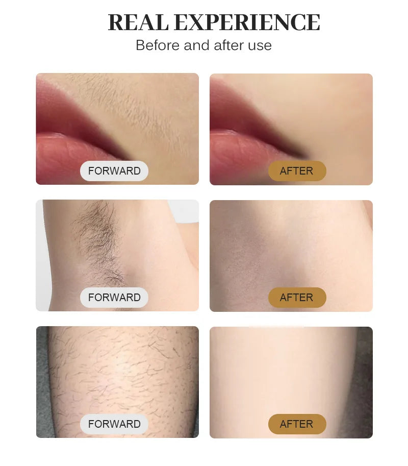 Myoslim 808nm Diode Laser Hair Removal Equipment With Ice Cooling